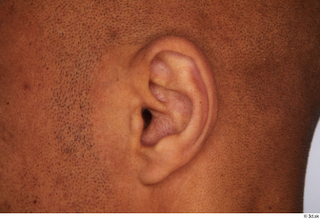 Tiago ear 0001.jpg